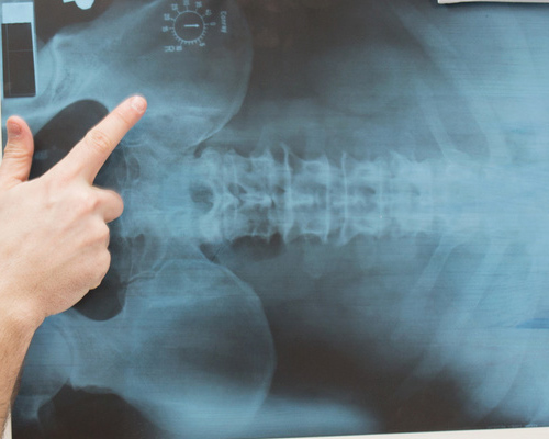 Anatomia della regione lombo-sacrale